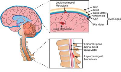 Preclinical Modeling and Therapeutic Avenues for Cancer Metastasis to the Central Nervous System